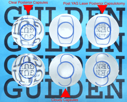 IOL Lens Set (for Gulden Models)-0