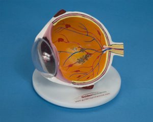 Vision Threatening Disease (VTD) Eye Model-0