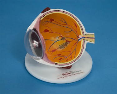 Vision Threatening Disease (VTD) Eye Model-0