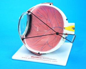 Lasik Eye Model-0