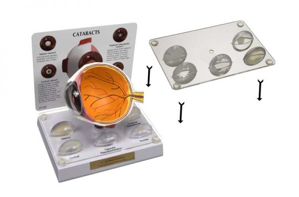 Lens Stabilizer for Cataract and IOL Models-0