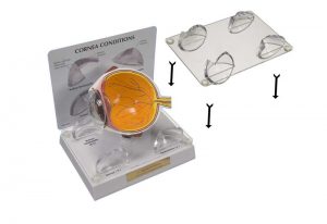 Lens Stabilizer for Cornea Model-0
