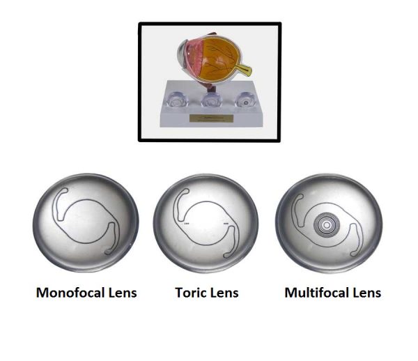 Premium IOL Options Lens Set-0
