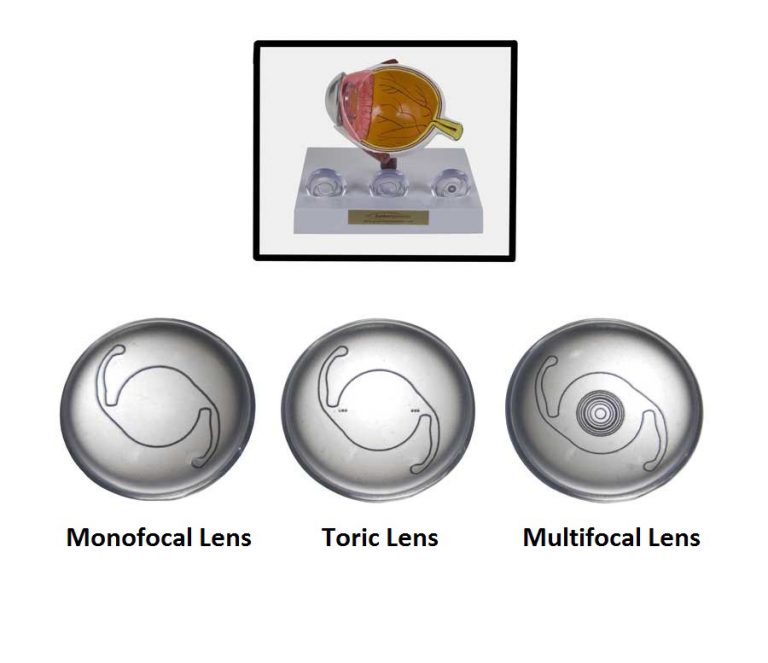 Premium Iol Options Lens Set