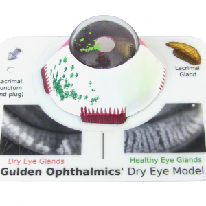 Dry Eye Model-0