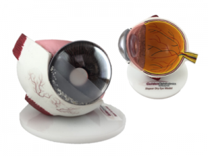 Siepser Dry Eye Model