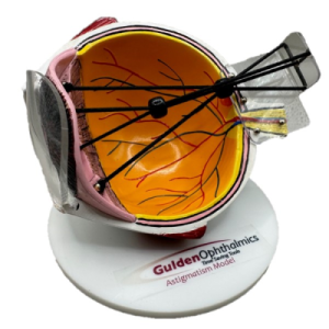 Astigmatism Eye Model